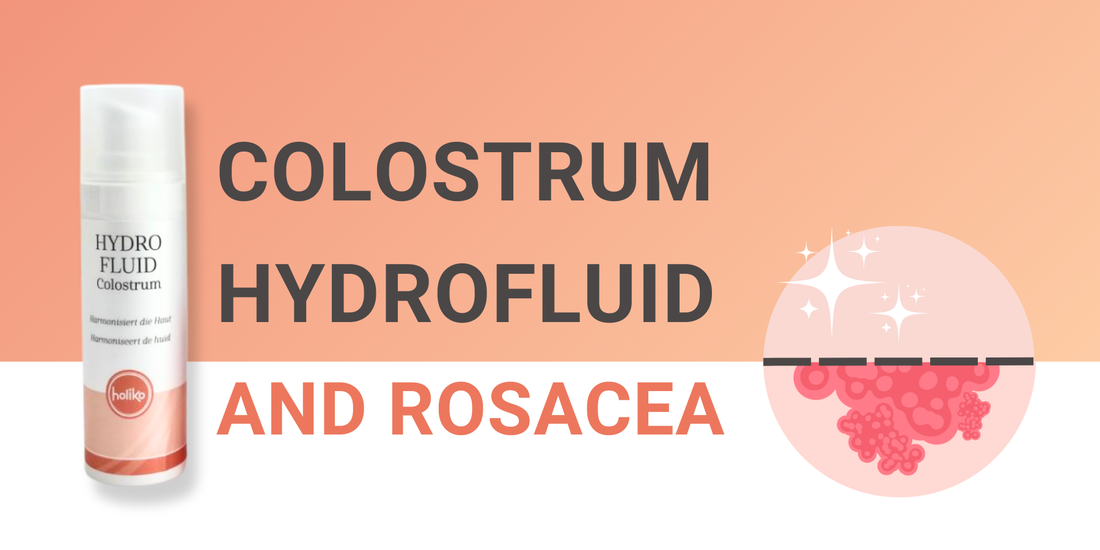 L'hydrofluide de colostrum et la rosacée